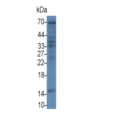 Follicle Stimulating Hormone Beta (FSHb) Human, Pig Monoclonal Antibody