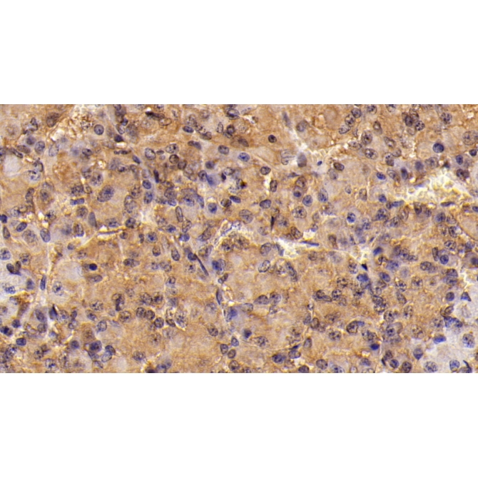 Follicle Stimulating Hormone Beta (FSHb) Mouse Monoclonal Antibody