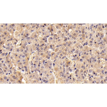 Follicle Stimulating Hormone Beta (FSHb) Mouse Monoclonal Antibody