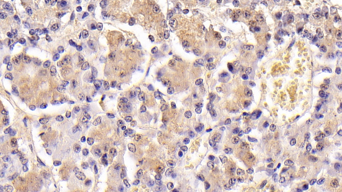 Follicle Stimulating Hormone Beta (FSHb) Rat Monoclonal Antibody