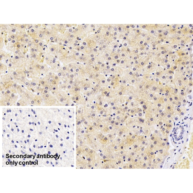 Ferritin, Light Polypeptide (FTL) Human Monoclonal Antibody