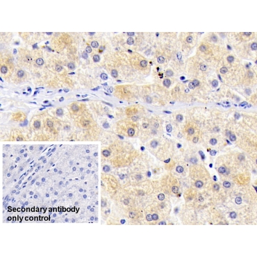 Ferritin, Light Polypeptide (FTL) Human Monoclonal Antibody