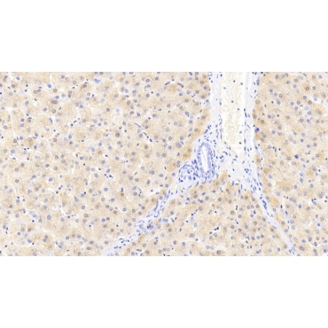 Ferritin, Light Polypeptide (FTL) Human Monoclonal Antibody