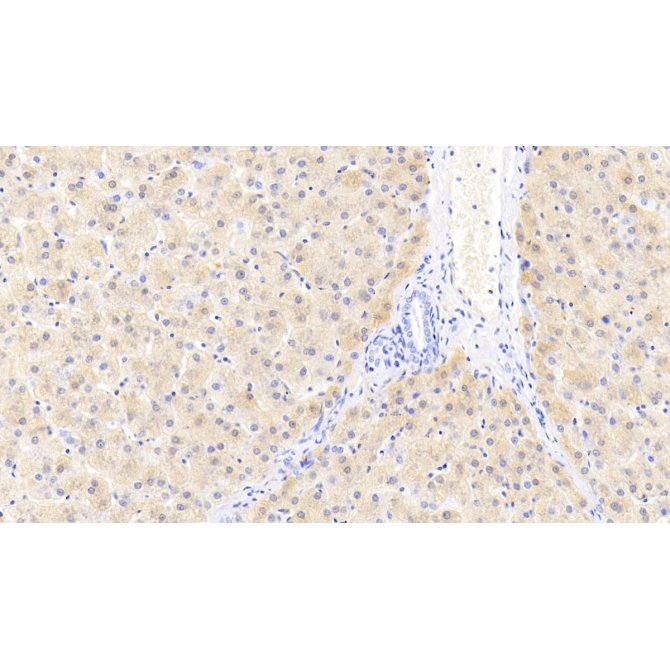Ferritin, Light Polypeptide (FTL) Human Monoclonal Antibody