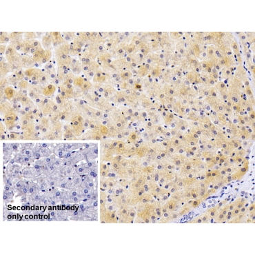 Ferritin, Light Polypeptide (FTL) Human Monoclonal Antibody
