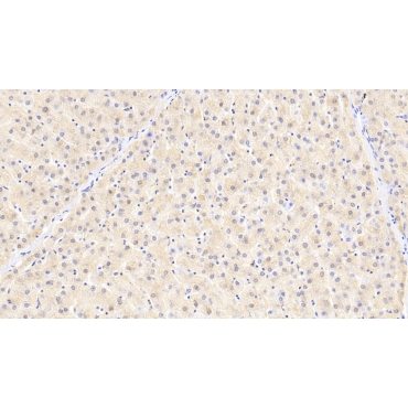 Ferritin, Light Polypeptide (FTL) Human Monoclonal Antibody