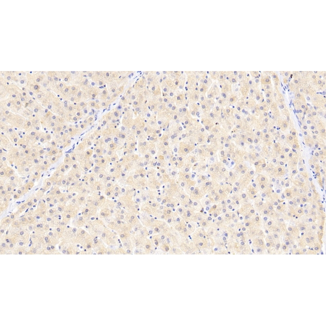 Ferritin, Light Polypeptide (FTL) Human Monoclonal Antibody