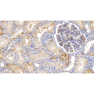 Ferritin, Heavy Polypeptide (FTH) Human Monoclonal Antibody