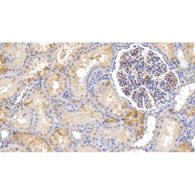 Ferritin, Heavy Polypeptide (FTH) Human Monoclonal Antibody