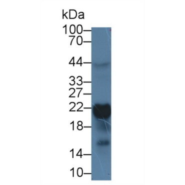 Ferritin, Heavy Polypeptide (FTH) Human Monoclonal Antibody