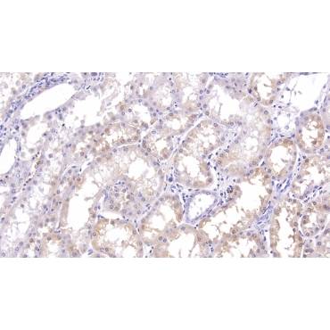 Ferritin, Heavy Polypeptide (FTH) Human Monoclonal Antibody