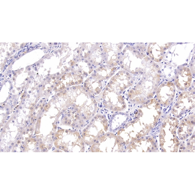 Ferritin, Heavy Polypeptide (FTH) Human Monoclonal Antibody