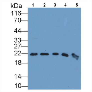 Ferritin, Heavy Polypeptide (FTH) Mouse Monoclonal Antibody