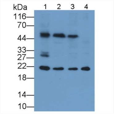 Ferritin, Heavy Polypeptide (FTH) Mouse Monoclonal Antibody