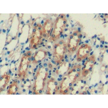 Ferritin, Heavy Polypeptide (FTH) Mouse Monoclonal Antibody