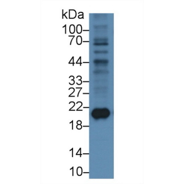 Ferritin, Heavy Polypeptide (FTH) Mouse Monoclonal Antibody