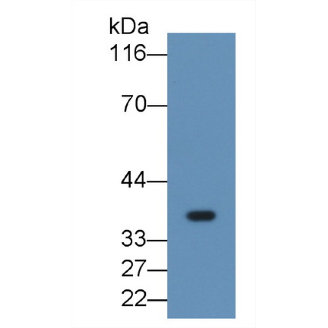 Fibrinogen Like Protein 1 (FGL1) Human Monoclonal Antibody