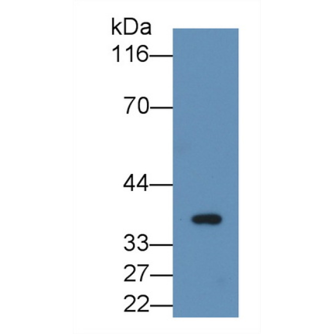 Fibrinogen Like Protein 1 (FGL1) Human Monoclonal Antibody