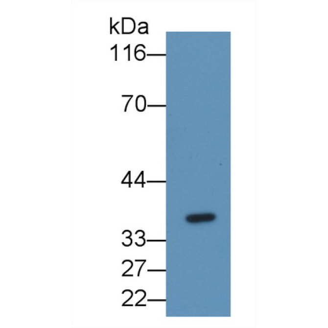 Fibrinogen Like Protein 1 (FGL1) Human Monoclonal Antibody