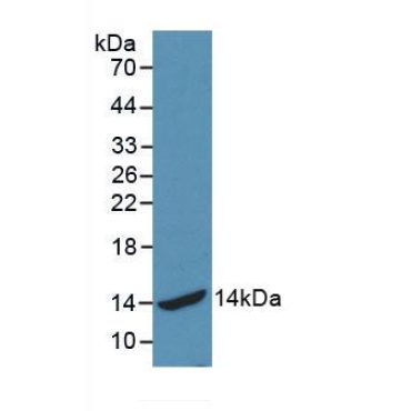 Heat Shock 70kDa Protein 2 (HSPA2) Human Monoclonal Antibody