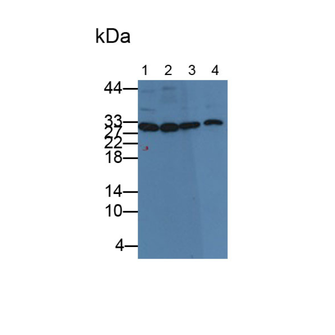 Carbonic Anhydrase III, Muscle Specific (CA3) Human Monoclonal Antibody
