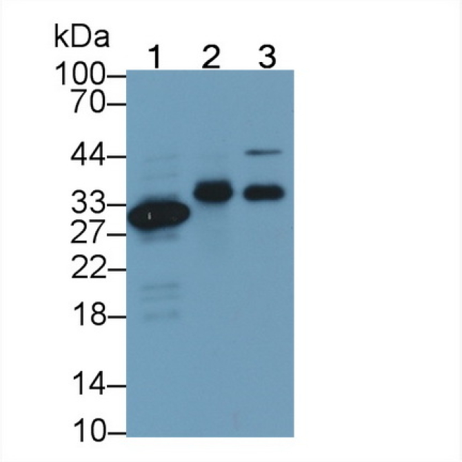 Carbonic Anhydrase IV (CA4) Human Monoclonal Antibody