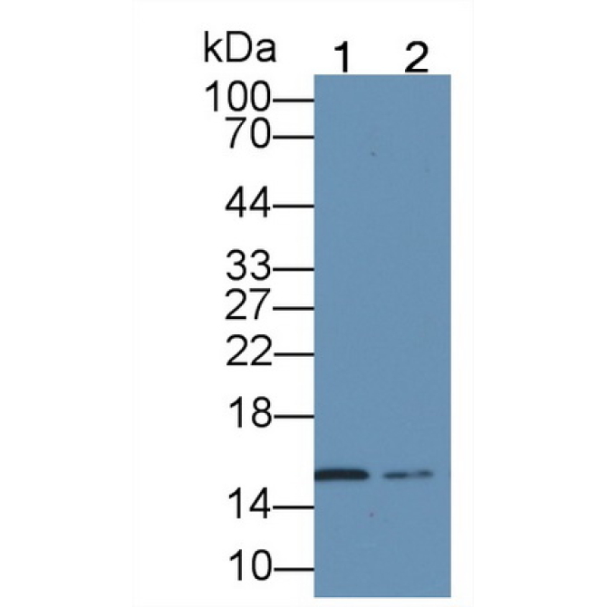 Hemoglobin Alpha 1 (HBa1) Human Monoclonal Antibody