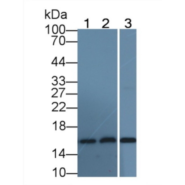 Hemoglobin Alpha 1 (HBa1) Human Monoclonal Antibody