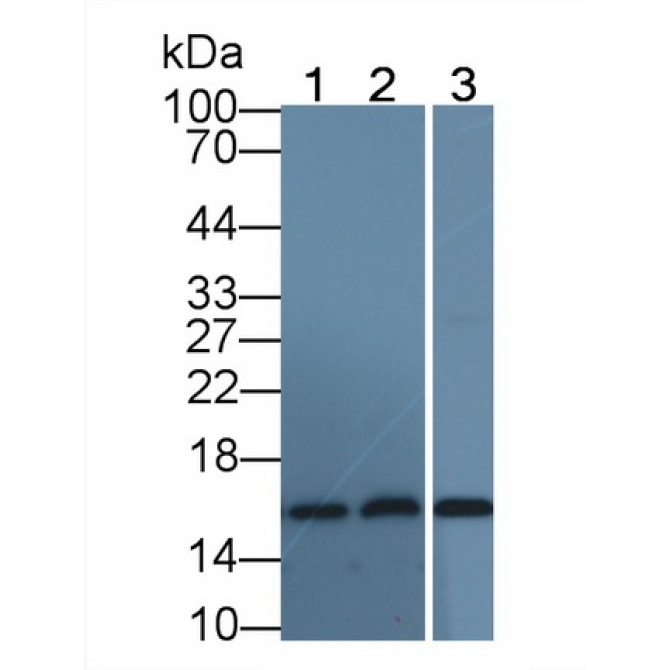 Hemoglobin Alpha 1 (HBa1) Human Monoclonal Antibody