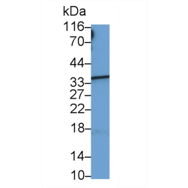 Hemoglobin Beta (HBb) Human Monoclonal Antibody