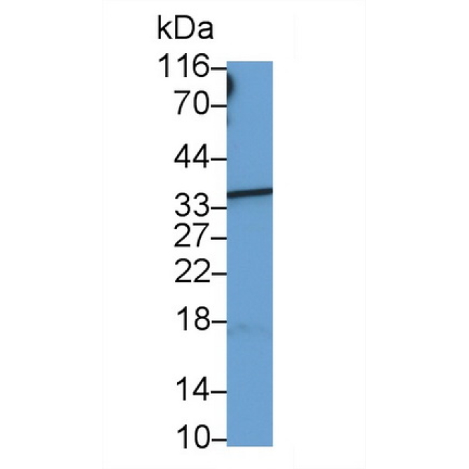 Hemoglobin Beta (HBb) Human Monoclonal Antibody