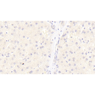Low Density Lipoprotein Receptor Related Protein 6 (LRP6) Human Monoclonal Antibody