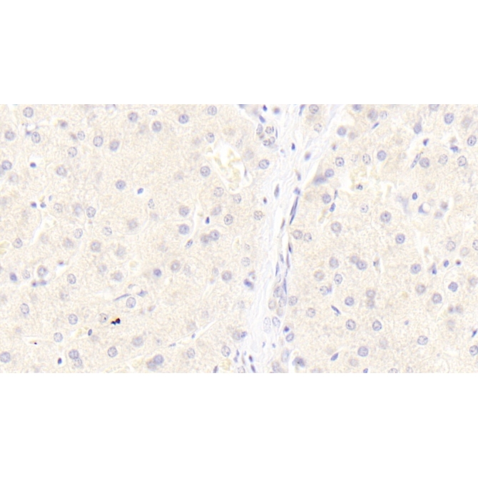 Low Density Lipoprotein Receptor Related Protein 6 (LRP6) Human Monoclonal Antibody