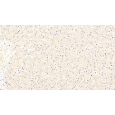 Low Density Lipoprotein Receptor Related Protein 6 (LRP6) Human Monoclonal Antibody