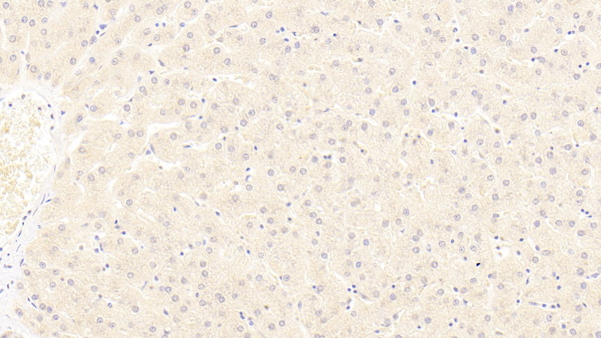 Low Density Lipoprotein Receptor Related Protein 6 (LRP6) Human Monoclonal Antibody