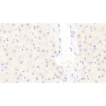 Low Density Lipoprotein Receptor Related Protein 6 (LRP6) Human Monoclonal Antibody