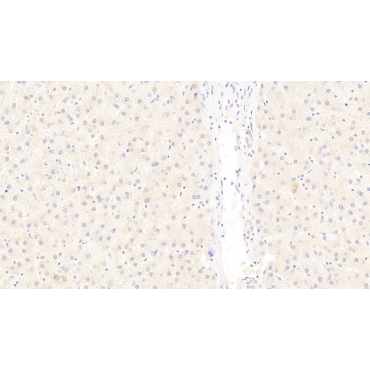 Low Density Lipoprotein Receptor Related Protein 6 (LRP6) Human Monoclonal Antibody