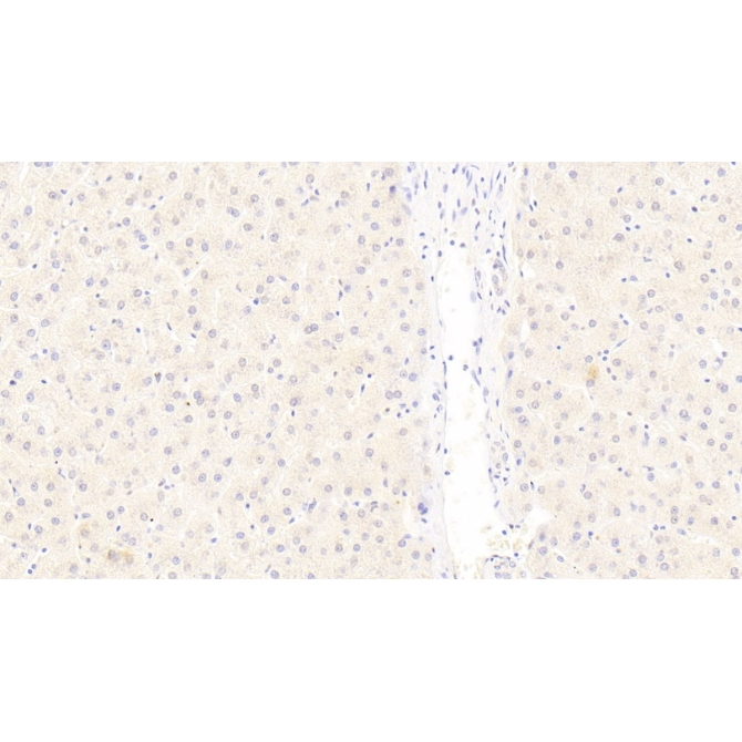 Low Density Lipoprotein Receptor Related Protein 6 (LRP6) Human Monoclonal Antibody