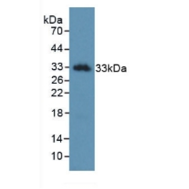 Kallikrein 2 (KLK2) Human Monoclonal Antibody
