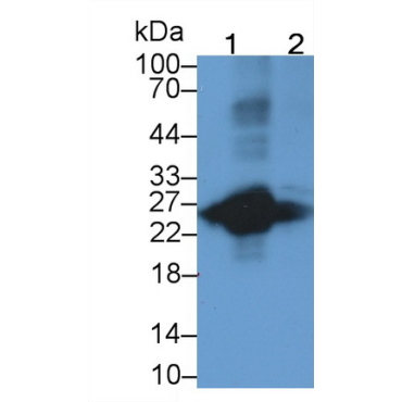 T-Cell Surface Glycoprotein CD3 Epsilon (CD3e) Human Monoclonal Antibody