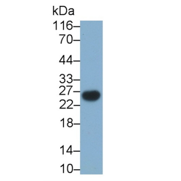 T-Cell Surface Glycoprotein CD3 Gamma (CD3g) Human Monoclonal Antibody