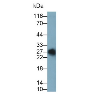 T-Cell Surface Glycoprotein CD3 Gamma (CD3g) Human Monoclonal Antibody