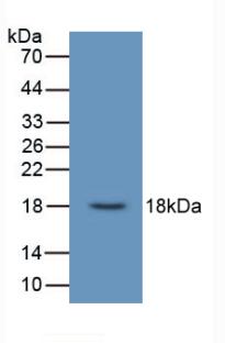 Urocortin 3 (UCN3) Human Monoclonal Antibody