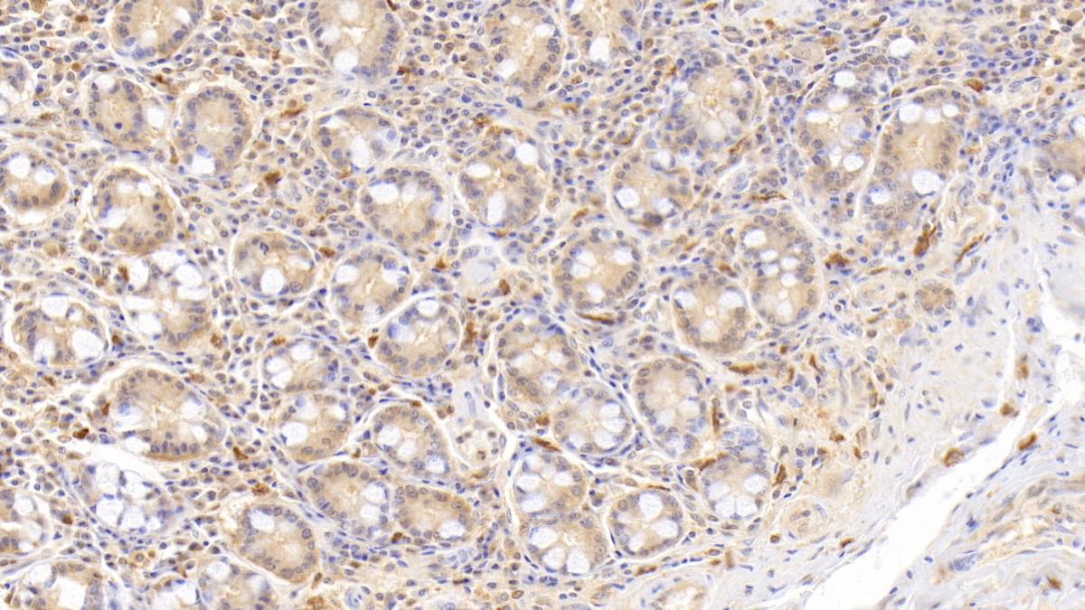 Ribonuclease A2 (RNASE2) Human Monoclonal Antibody