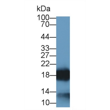 Ribonuclease A2 (RNASE2) Human Monoclonal Antibody
