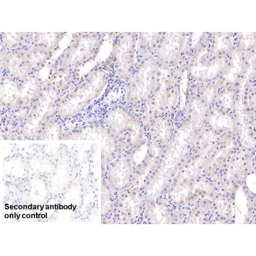 Ribonuclease A2 (RNASE2) Human Monoclonal Antibody