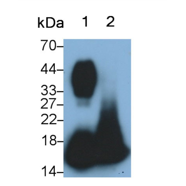 Ribonuclease A2 (RNASE2) Human Monoclonal Antibody