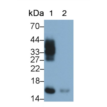 Ribonuclease A2 (RNASE2) Human Monoclonal Antibody