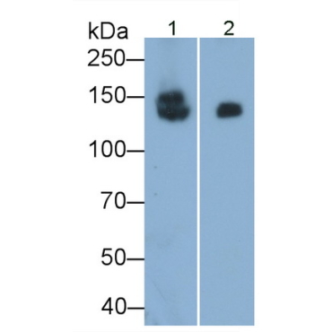 Sucrase Isomaltase (SI) Human Monoclonal Antibody