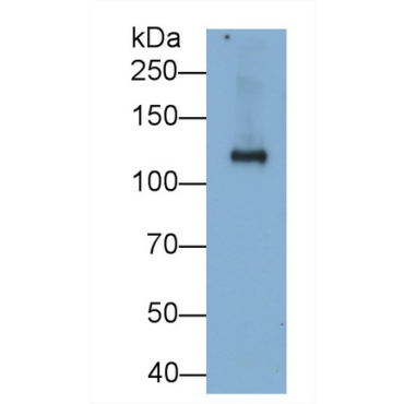 Sucrase Isomaltase (SI) Human Monoclonal Antibody